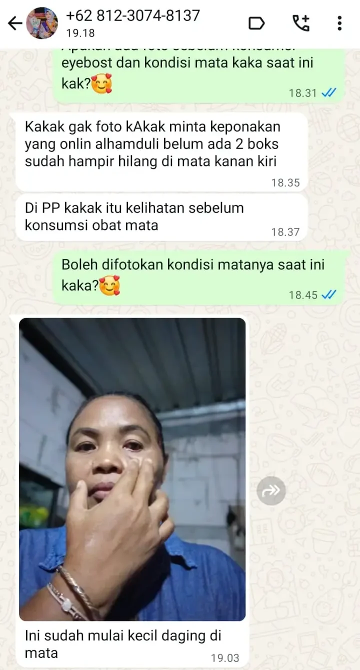 LEMAK-MATA.webp