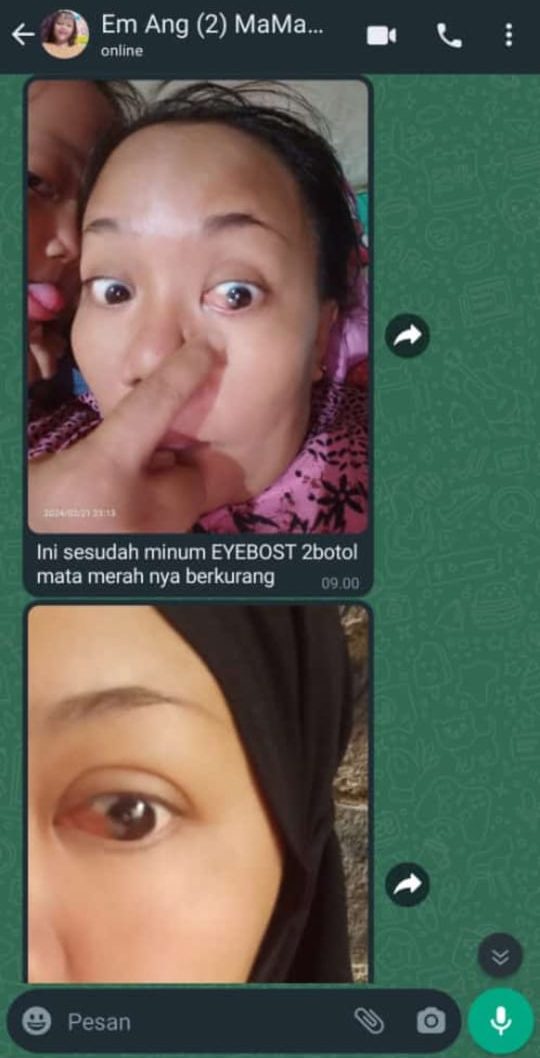 testi-lemak-mata-2-